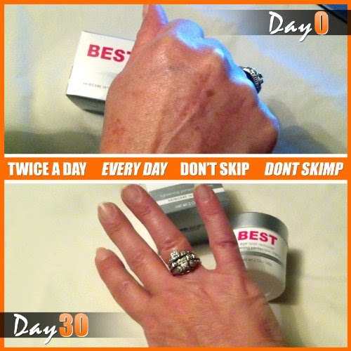 Best Age Spot Remover – Dark Spot Corrector, Skin ...