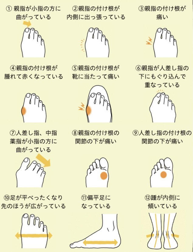 川崎店 お悩み別特集 外反母趾編 Akaishi 直営店 外反母趾 足底筋膜炎など足の悩みを靴で解決 東京 静岡