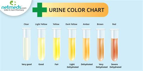  urine color chart