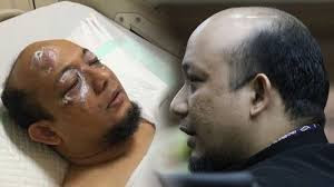 Sketsa Wajah Tersangka Penyerangan Novel Baswedan