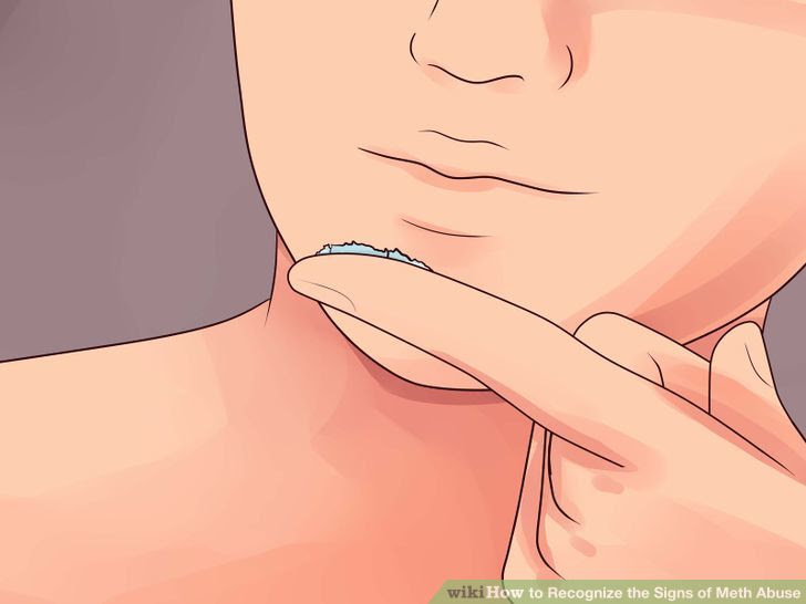 Recognize the Signs of Meth Abuse Step 16.jpg