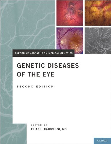 Genetic Diseases of the Eye (Oxford Monographs on Medical Genetics), by Elias I Traboulsi MD