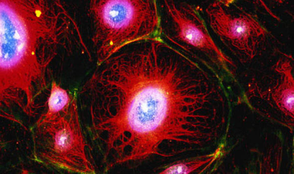 Dying cancer cells 