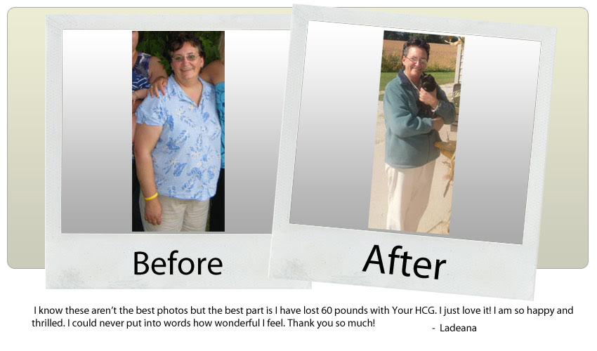 hcg drops before and after photos. hcg diet drops before after