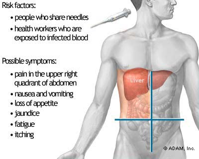 kidney dialysis holidays