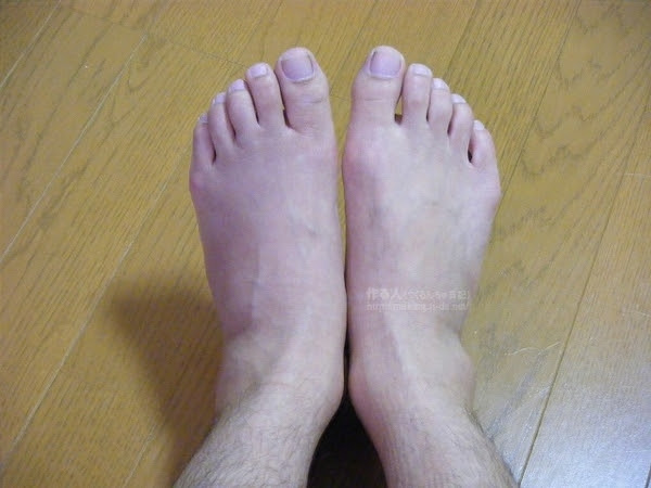 復活 ギブスを外す 骨折2週間目 作る人 つくるんちゅ 日記