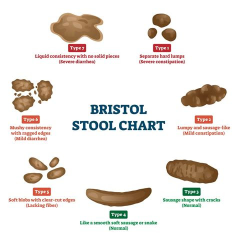 Normal stool color can range from light yellow to brown to almost black. what is the bristol stool chart 8 sample stool color charts sample