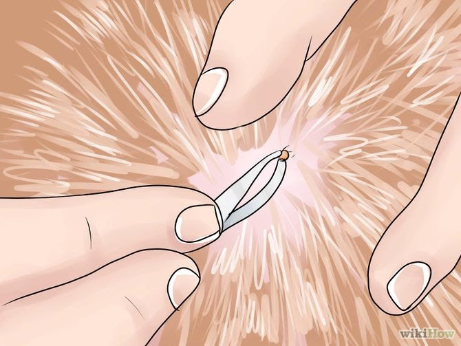 How to Cure Mange in Dogs: 13 Steps (with Pictures) - wikiHow