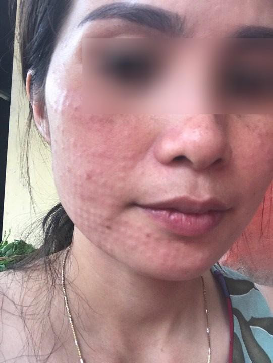 Bổ sung collagen không vội được đâu, cẩn thận 