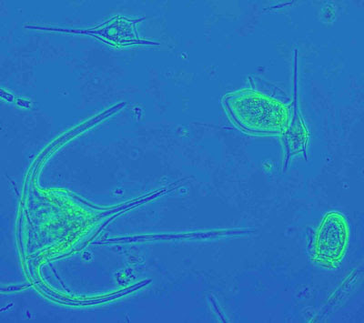 parts insect of Phase Microscopy Colour Contrast parts insect of Phase Microscopy Colour Contrast