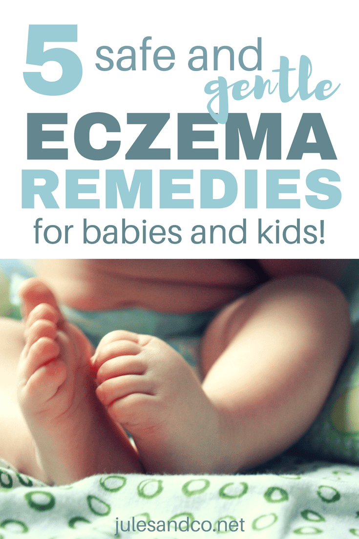 Baby Eczema: Natural Remedies for This Common Skin Condition