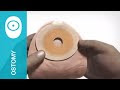 【印刷可能】 one piece ostomy 125251-1 piece ostomy