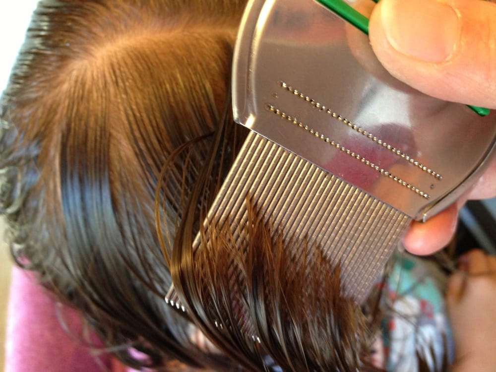 Sacramento Lice Removal Service - Reviews - Yelp