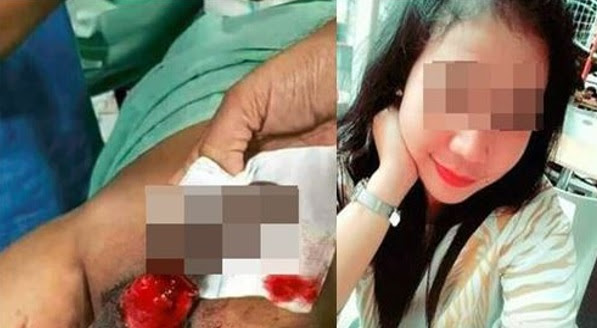 Berang Tak Dapat Jatah Malam Jumaat, Isteri Kerat Anu Suami