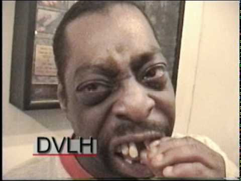Beetlejuice's teeth...before his dentist appointment to ...