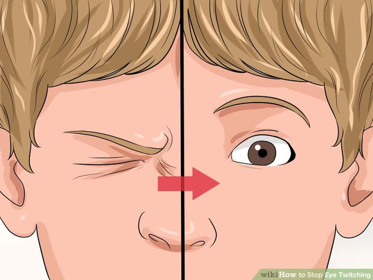 Stop Eye Twitching Step 1 Version 2.jpg