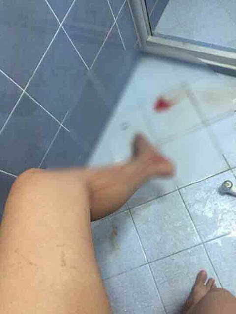 Man Was Bitten By A Huge Snake That Came Out Of His Toilet, What He Did Next Was Shocking!