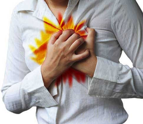  and symptoms of acid reflux or gastroesophageal reflux disease (GERD