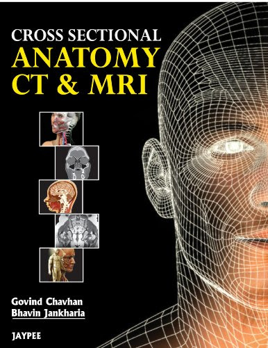 Cross Sectional Anatomy CT and MRI, by Govind Chavhan