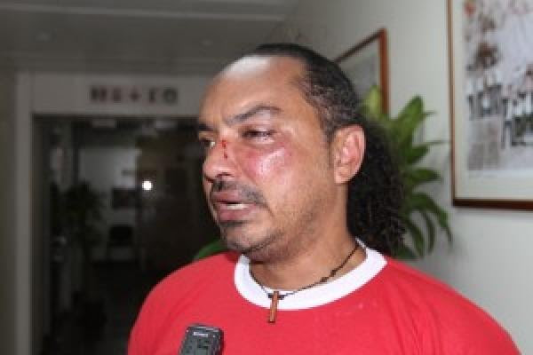 Luis “Layo” Gascuez