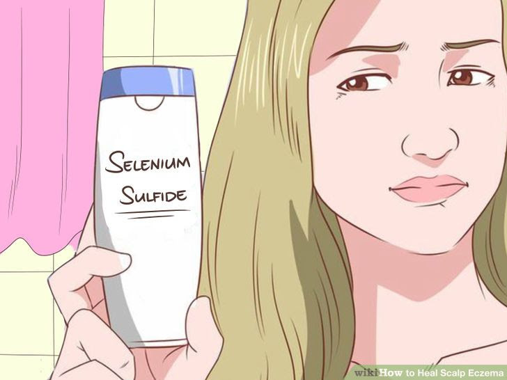 Heal Scalp Eczema Step 10 Version 3.jpg