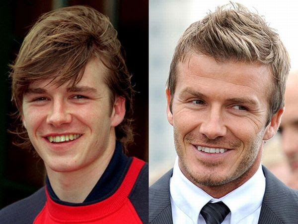 Famous 
Smiles. Before and After (10 pics)