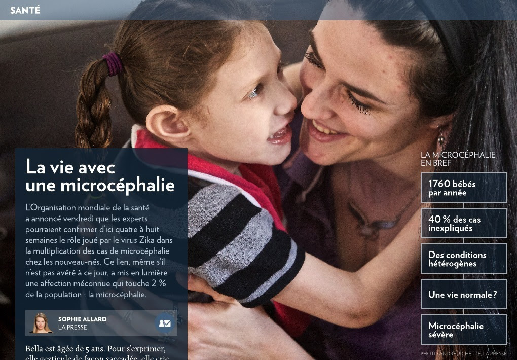 La Vie Avec Une Microcephalie La Presse