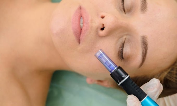 Cool Can You Use Vitamin C After Microneedling Knowledge