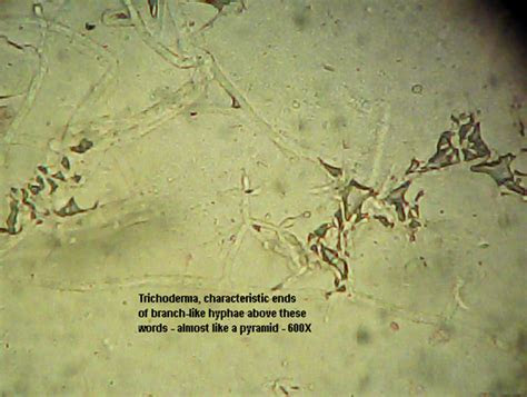 trichoderma create  healthy home