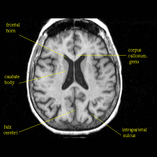 clear your sinuses strain points