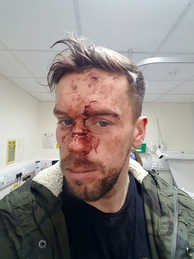 LIFESTYLE: 'Blood everywhere': Groom-to-be gets attacked at pub, shows up for wedding the next day