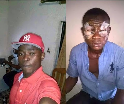 Man Left Blinded in Both Eyes After Being Attacked with Acid Over Land Dispute in Anambra Man Left Blinded in Both Eyes After Being Attacked with Acid Over Land Dispute in Anambra