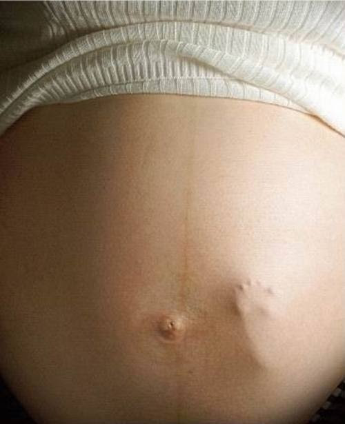 pictures of 8 weeks pregnant belly