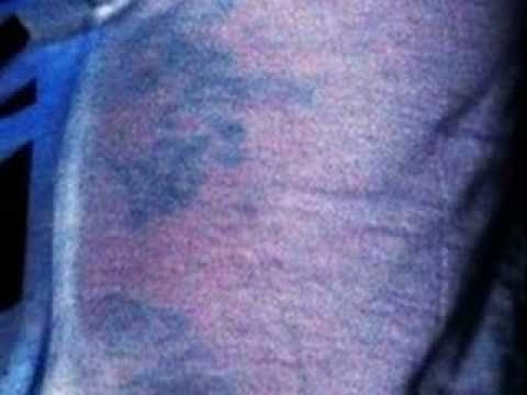 Bill Kaulitz New Tattoo: Part 2!!!! NEW PICS OF BILL'S NEW TAT!