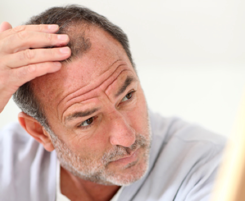 40代の薄毛に効く髪型の2大セオリーとは 40代の外見 ファッション