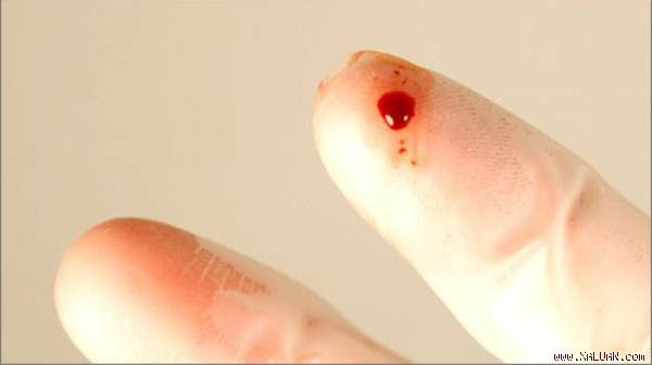 Làm gì khi có nguy cơ phơi nhiễm HIV?