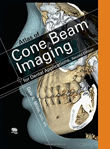 Atlas of Cone Beam Imaging for Dental Applications, by Dale A. Miles