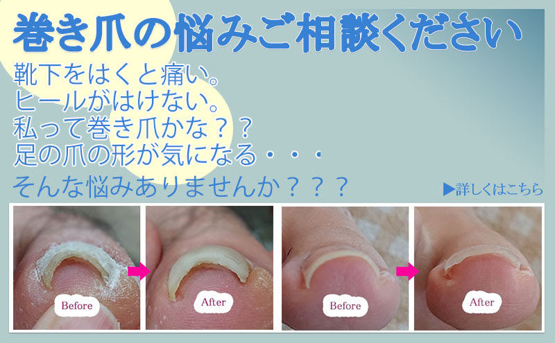 クラウンローズ 青森市ネイル まつエク まつ毛カール 水素吸入 タトゥーカバー シャイニージェルショップ スクール