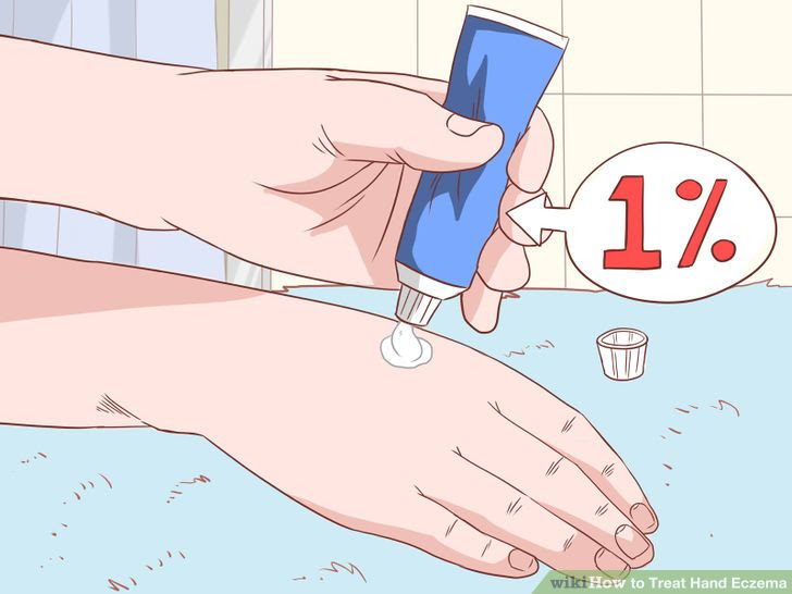 Treat Hand Eczema Step 7 Version 2.jpg