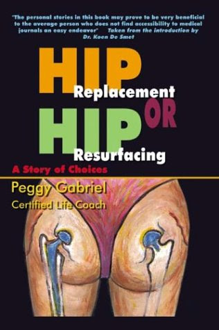 Resurfacing Hip Arthroplasty. Get Hip Replacement or Hip