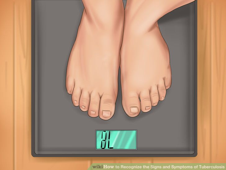 Recognize the Signs and Symptoms of Tuberculosis Step 8.jpg