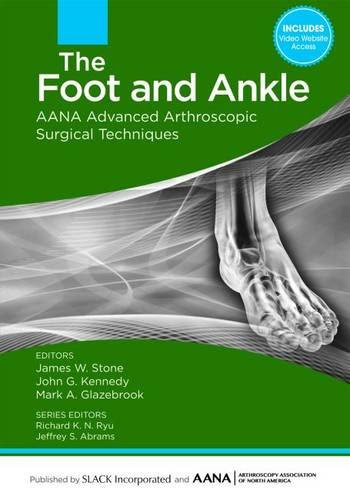 The Foot and Ankle: AANA Advanced Arthroscopic Surgical Techniques