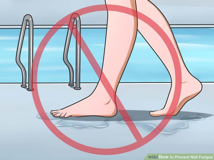 Prevent Nail Fungus Step 7.jpg