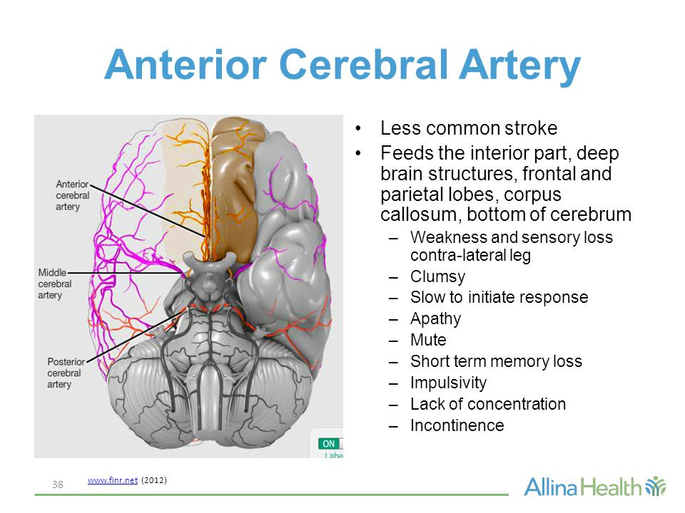stroke patient businesses