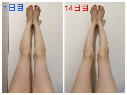 緊急実証 2週間で太ももサイズが 6センチ減 パンパンにむくんだ足でも夏までに即スリムできる秘密の とは Peachy ライブドアニュース