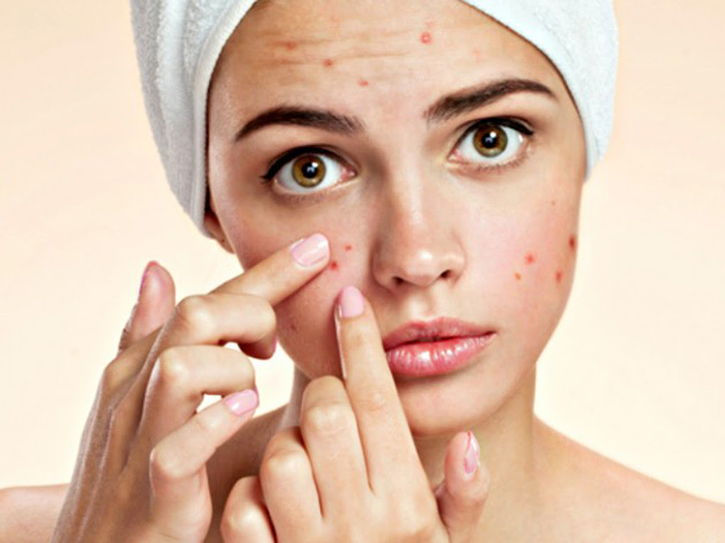 Mụn xuất hiện trên da mang đến nhiều phiền toái, không được điều trị đúng cách sẽ để lại hệ lụy lâu dài