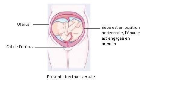 Bebe En Transverse Ou Comment S Affaler Dans Mon Ventre Le Blog De A La Mere Si