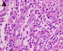 Ndu Pathology 病理組織鑑別診断の手引き
