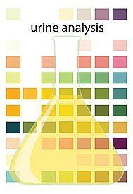  10 colors that suggest urine trouble green urine urinal light green