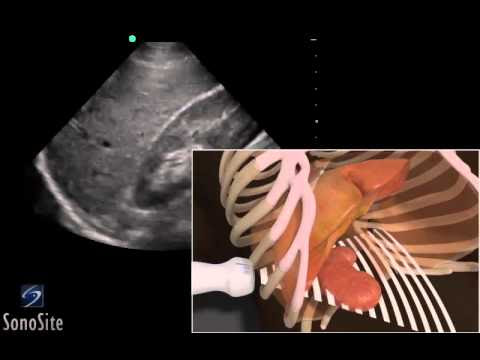 Transducer